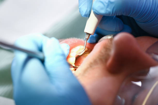 Best Emergency TMJ Treatment in Albers, IL