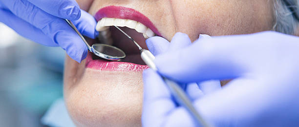 Best Urgent Care for Lost Fillings or Crowns in Albers, IL